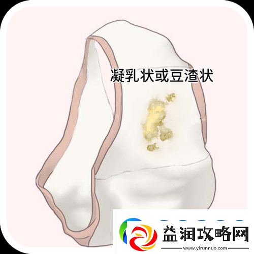 女生次数多了会有豆腐渣分泌物吗：相关问题深度剖析