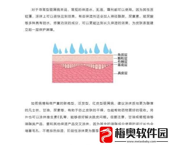 翁止熄痒最简单处理方法：快速缓解瘙痒